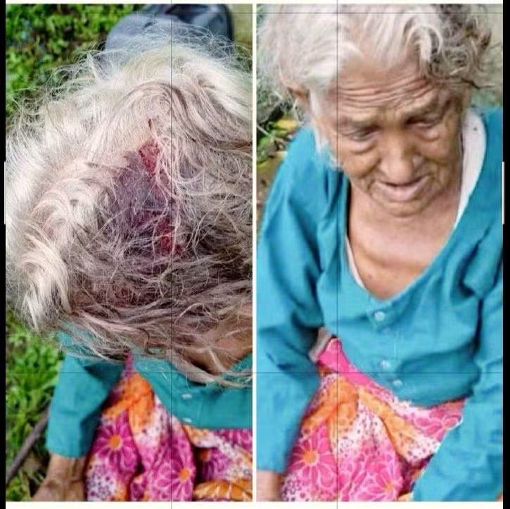 1घायल महिला 100 में से 100 अंक वाले रामनगर हॉस्पिटल से रैफर…😪