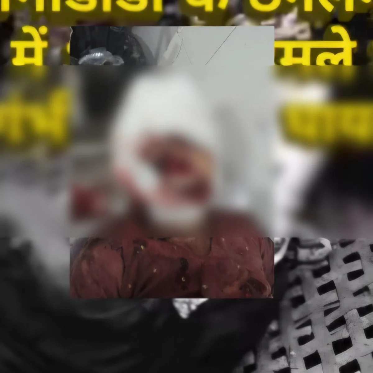 गढ़वाल में भालू ने महिला को मारा!